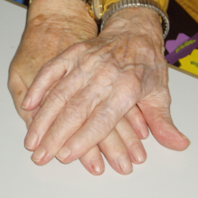Krankenpflegeverein